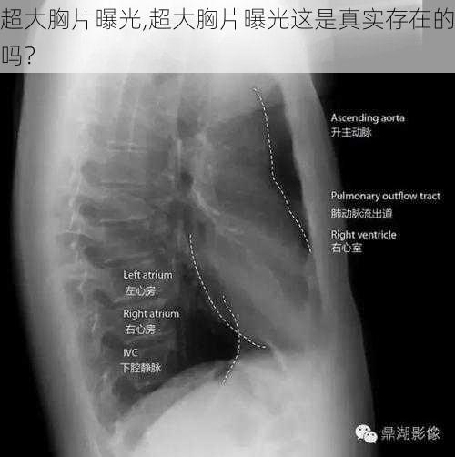 超大胸片曝光,超大胸片曝光这是真实存在的吗？